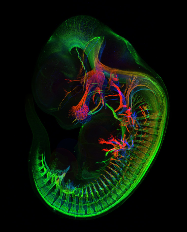 Mr. Zhong Hua
Department of Molecular Biology &amp; Genetics, Johns Hopkins University School of Medicine
Baltimore, Maryland, USA
Peripheral nerves in E11.5 mouse embryo
Confocal
5X